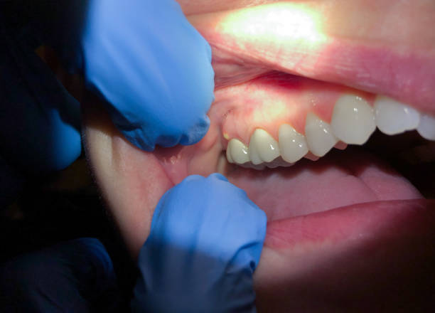 Best Knocked-Out Tooth Emergency  in Sa Conejo, CA